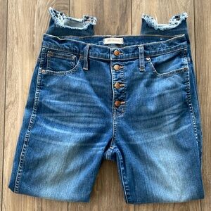 Madewell Button Fly Chewed Hem Skinny Jean